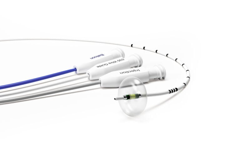 Catetere a palloncino per estrazione dei calcoli – Minimize
