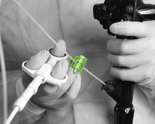 THE SINGLE-OPERATOR REVOLUTION: MASTERING POLYPECTOMY WITH HOLDFINGER