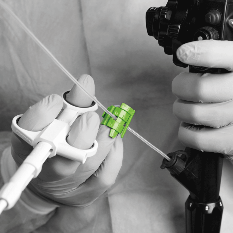 THE SINGLE-OPERATOR REVOLUTION: MASTERING POLYPECTOMY WITH HOLDFINGER